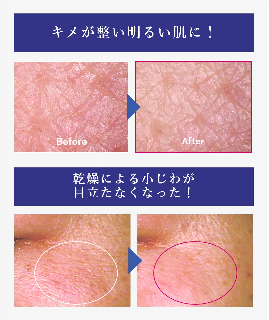 Meishoku PLACENTA EXTRACT ESSENSE 30mL